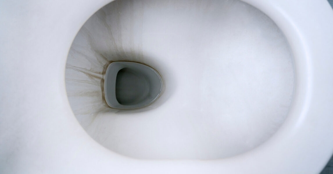 Comment enlever le tartre noir des toilettes