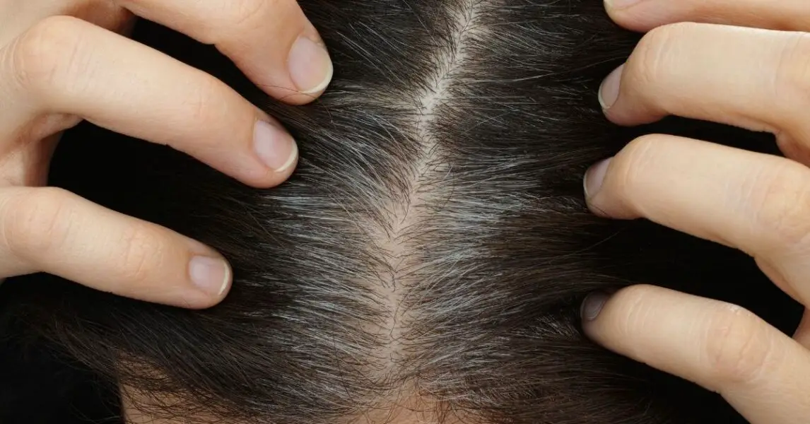 ¿Por qué aparecen las canas? 4 trucos efectivos para cubrirlas sin dañar tu hermoso cabello