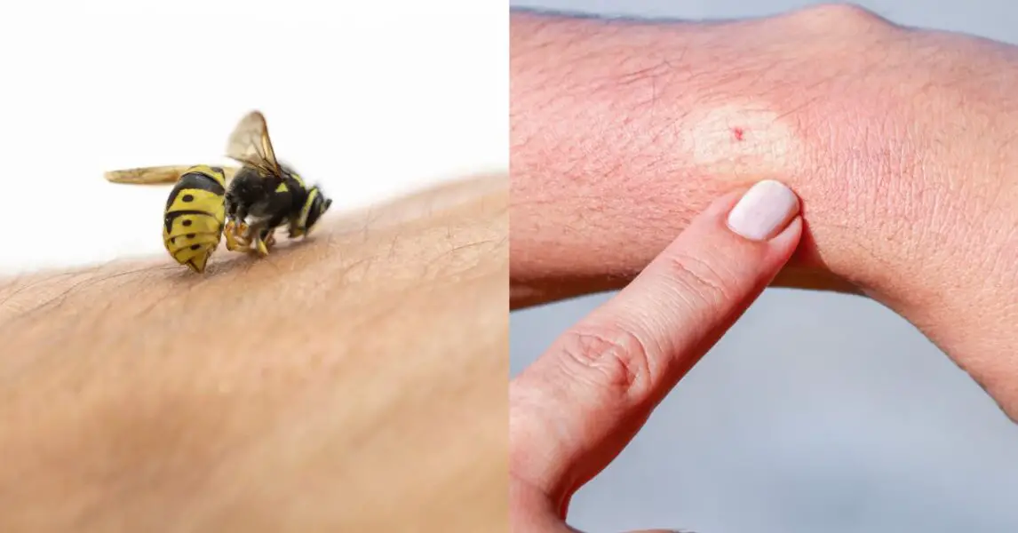 Que significa que te pique una abeja en la mano