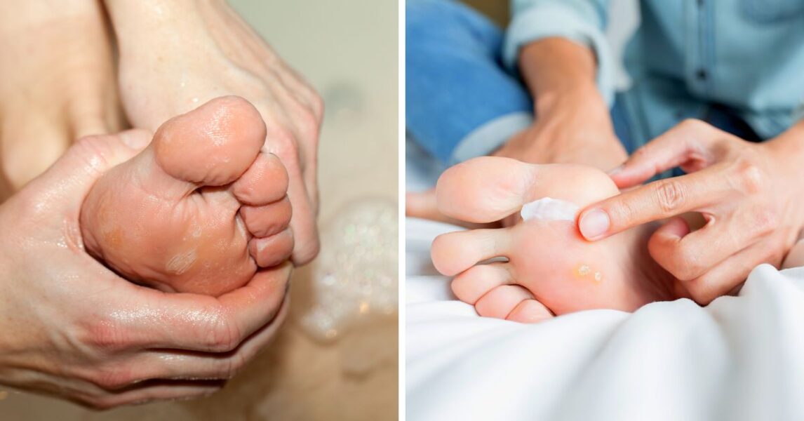 El truco del bicarbonato de sodio para pies suaves